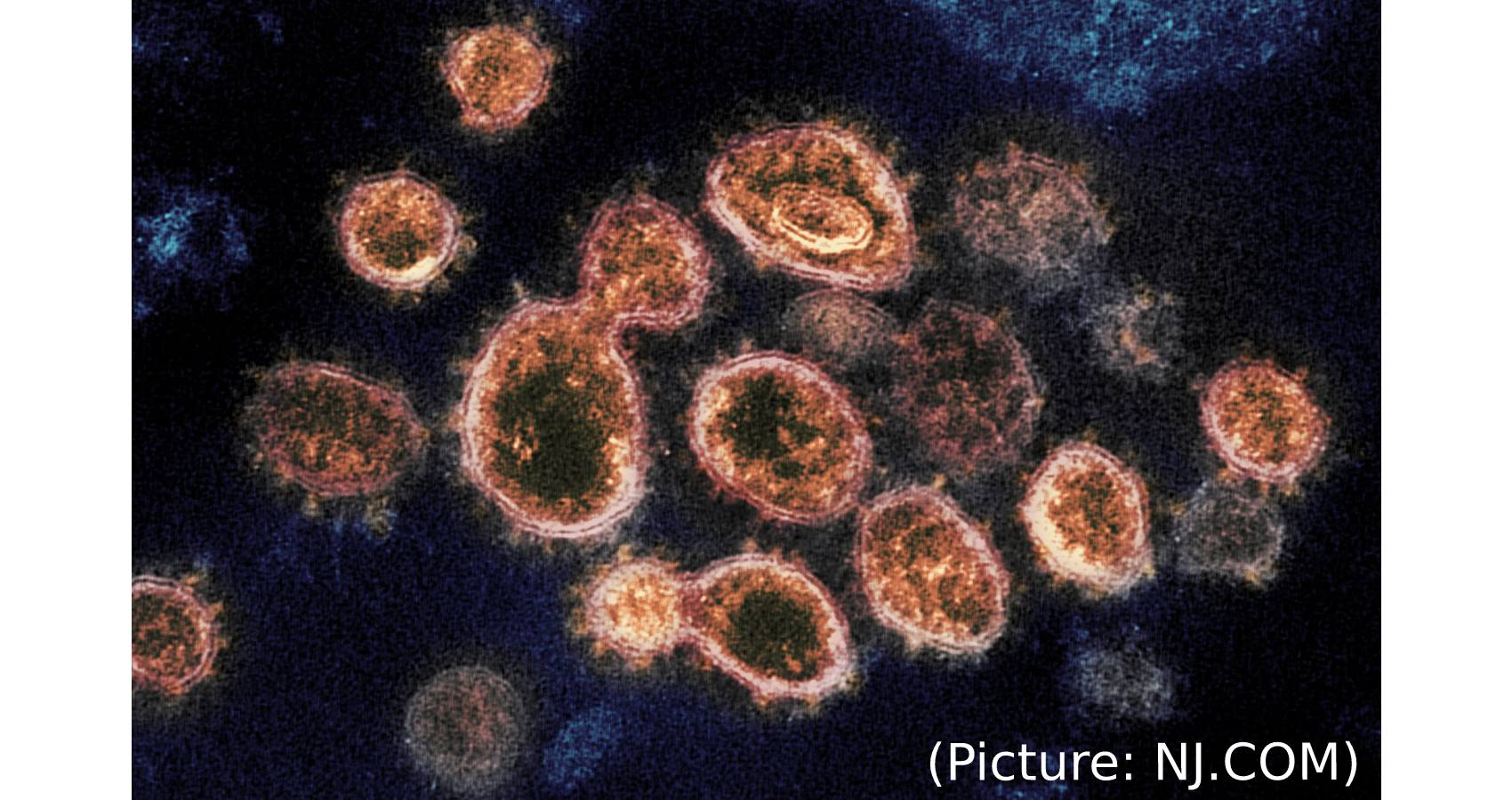 Pandemic Of The Unvaccinated’ Spreads In US, Fueled By Delta