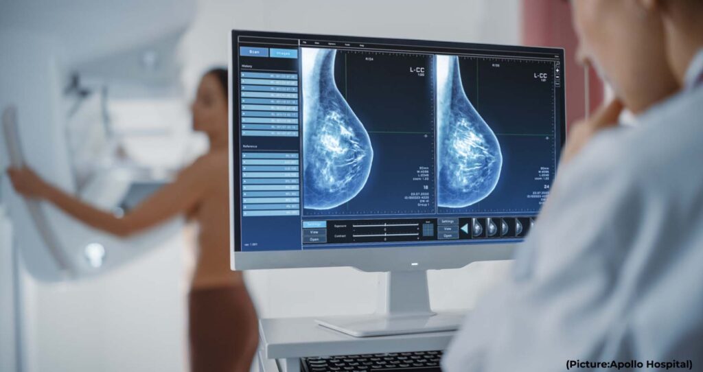 50% Of Women Face False Positive Mammograms After 10 Years Of Annual Screening