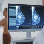 50% Of Women Face False Positive Mammograms After 10 Years Of Annual Screening
