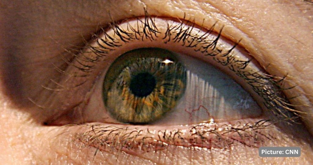 Innovative Stem Cell Technique Shows Promise in Restoring Vision for Single-Eye Injuries