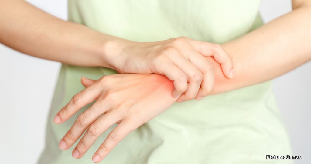 Featured & Cover Coping Strategies for Indian Americans Living with Rheumatoid Arthritis