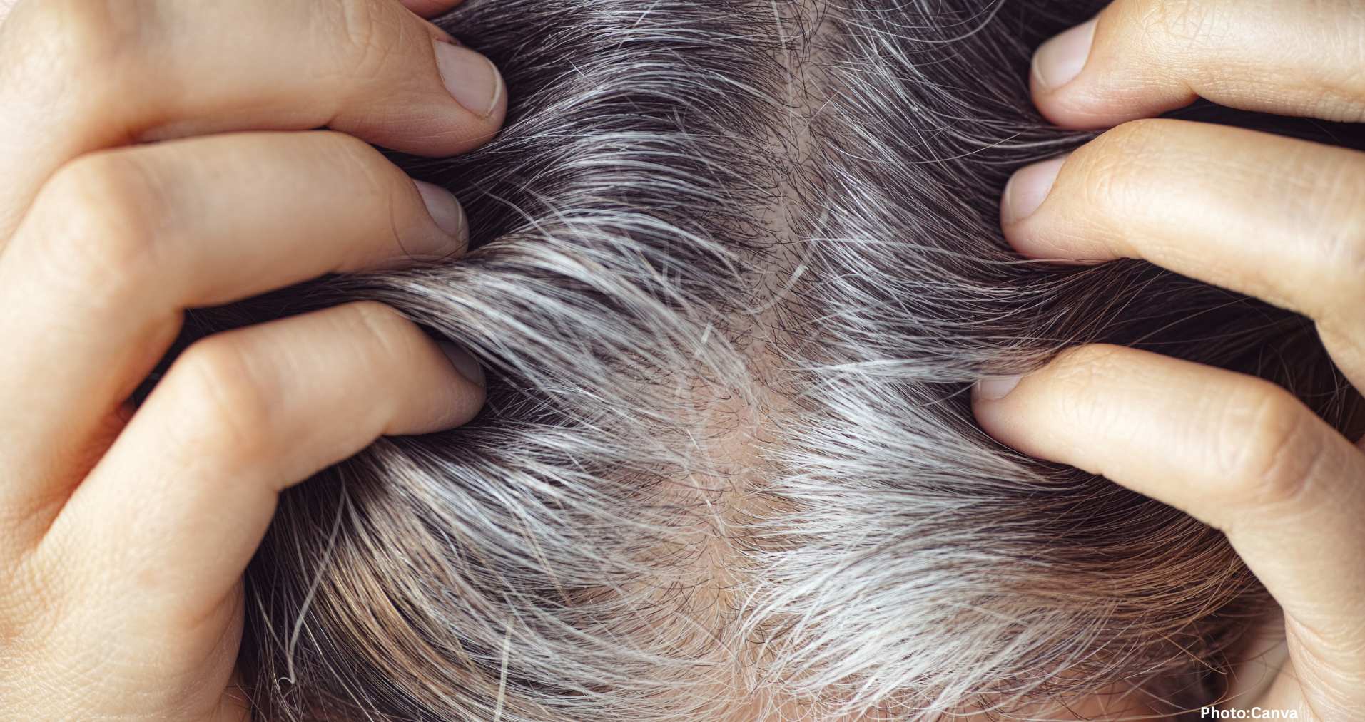 Feature and Cover Gray Hair May Contribute to Cancer Defense Study Finds