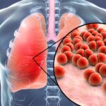 Featured & Cover Growing Antibiotic Crisis May Lead to Deadly Bacterial Infections