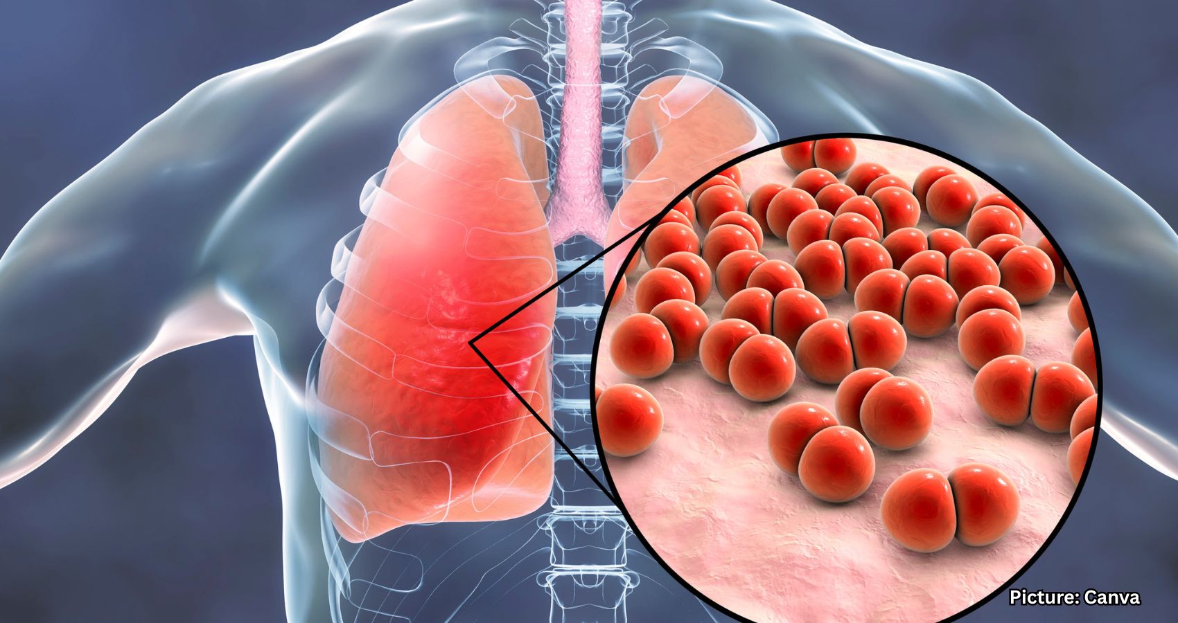 Featured & Cover Growing Antibiotic Crisis May Lead to Deadly Bacterial Infections