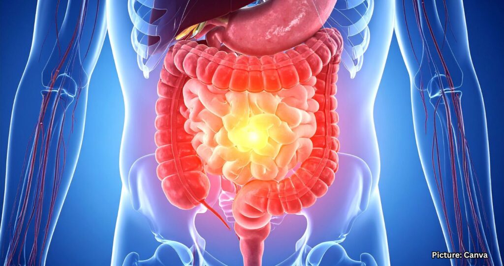 Popular Medications May Impact Gut Health for Years, Experts Warn