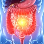 Featured & Cover Popular Medications May Impact Gut Health for Years Experts Warn