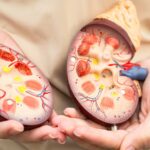 Feature and Cover Killer Condition Surges into Top 10 Causes of Death Worldwide