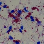 Feature and Cover New Study Shows Leprosy Existed in the Americas Before European Arrival