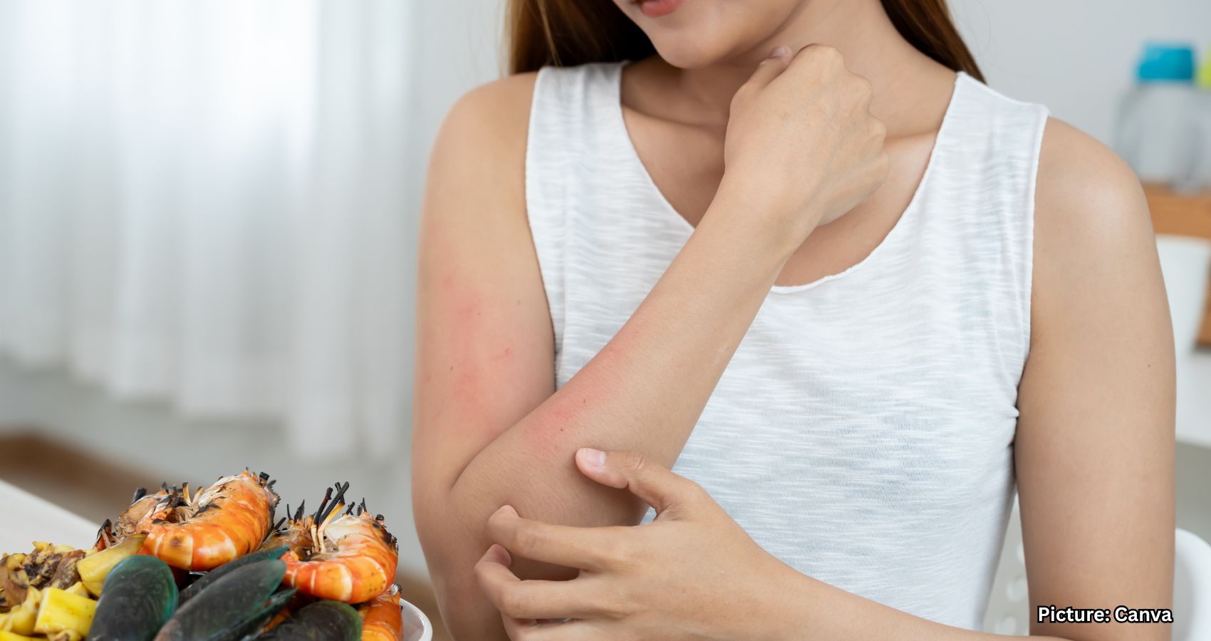 Featured & Cover Doctors Warn of Alarming Increase in Adult Onset Food Allergies