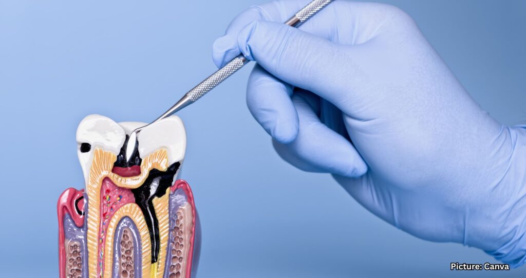 Treating Gum Disease May Lower Risk of Heart Attacks and Strokes