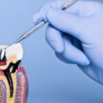 Featured & Cover Treating Gum Disease May Lower Risk of Heart Attacks and Strokes