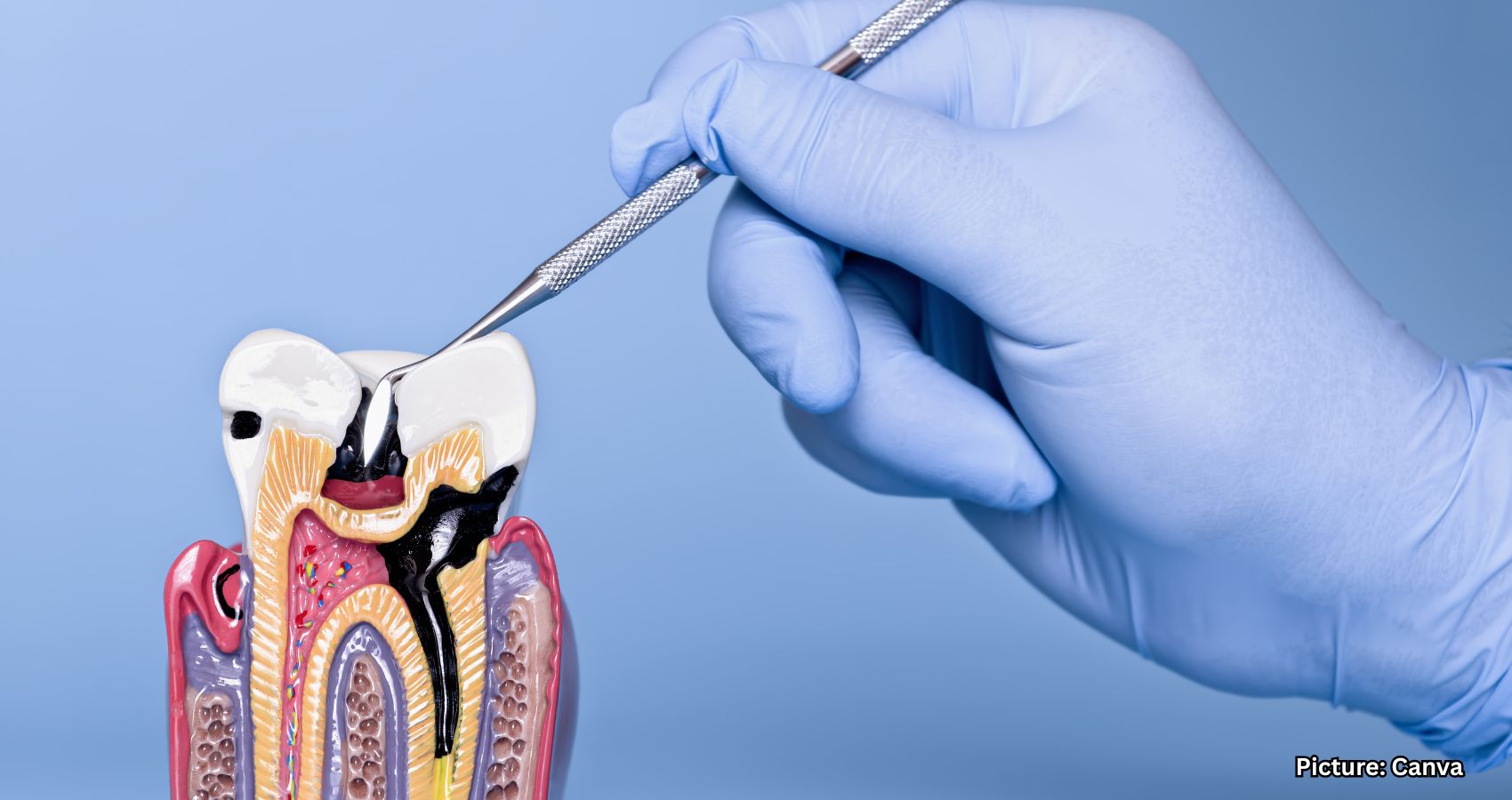 Featured & Cover Treating Gum Disease May Lower Risk of Heart Attacks and Strokes