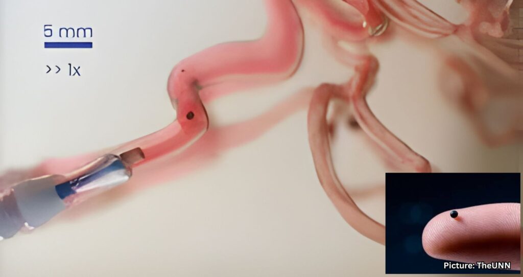 Grain-Sized Robot May Revolutionize Drug Delivery for Doctors