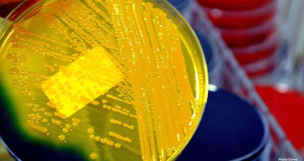 Deadly Superbug Spreads Across U.S. Amid Growing Drug Resistance