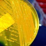 Feature and Cover Deadly Superbug Spreads Across U S Amid Growing Drug Resistance