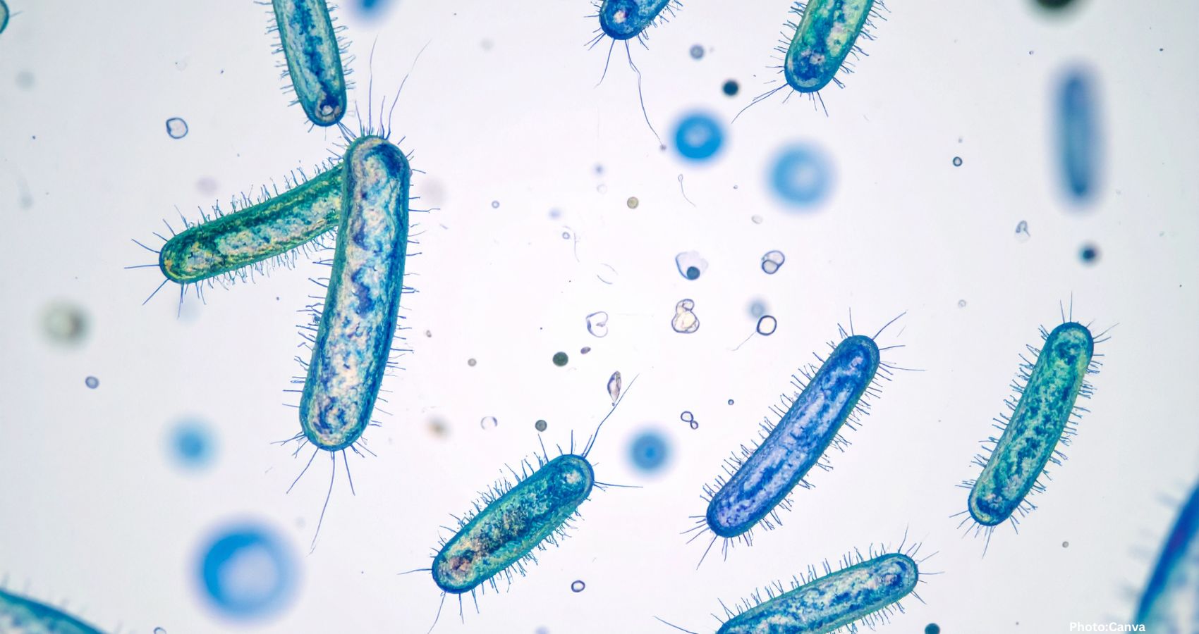 Feature and Cover Hidden Virus in Gut Bacteria Linked to Increased Colorectal Cancer Risk