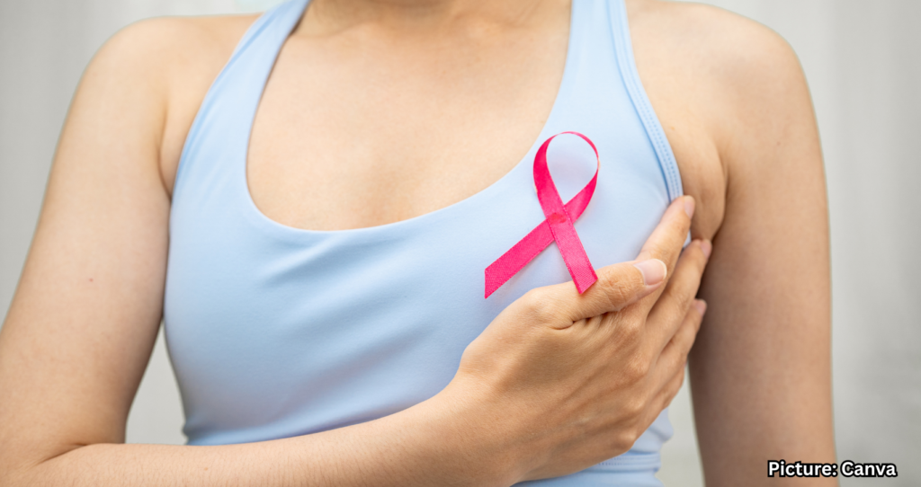 Indian-American Women at Increased Risk for Breast Cancer Due to Lack of Screening