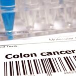 Feature and Cover Origin of Deadly Cancer in Young Adults Revealed in New Report