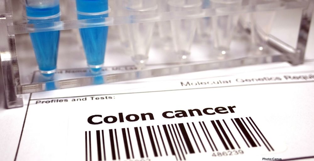 Feature and Cover Origin of Deadly Cancer in Young Adults Revealed in New Report