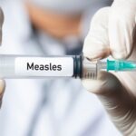 Featured & Cover Deepanwita Dasgupta's Measles Experience Highlights Long Term Health Risks