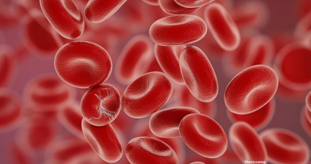 Cancer Risk Associated with Common Blood Condition, Research Finds