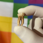 Featured & Cover New Study Finds Leprosy in the Americas Before European Arrival