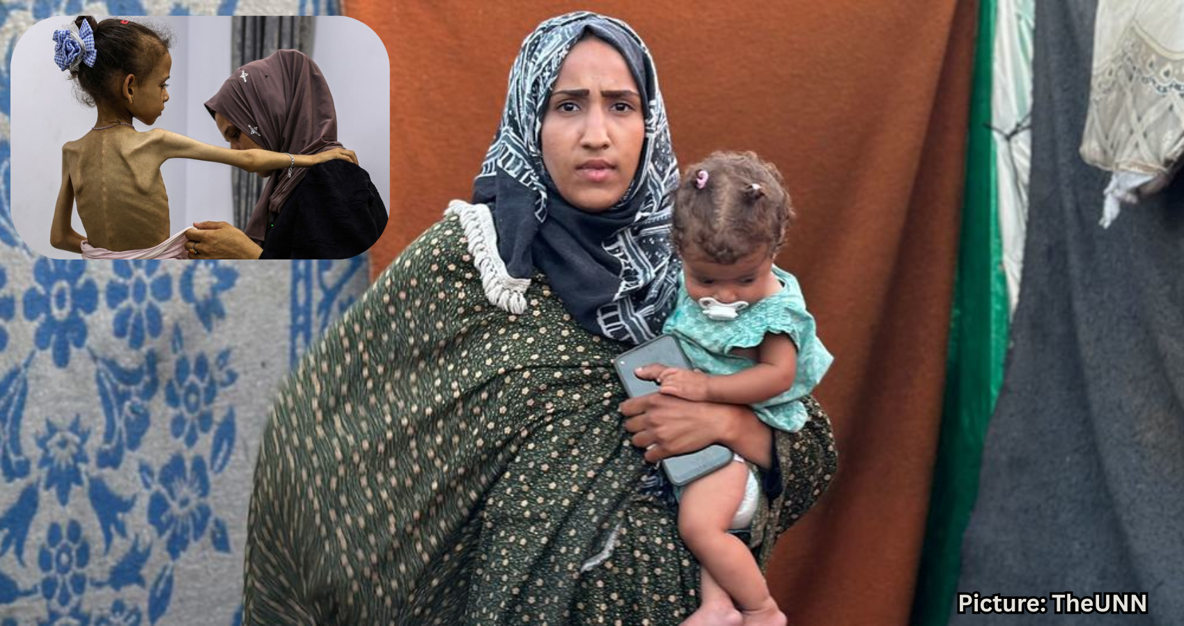 UN Data Challenges Viral Claims of Famine in Gaza Amid Declining Child Malnutrition