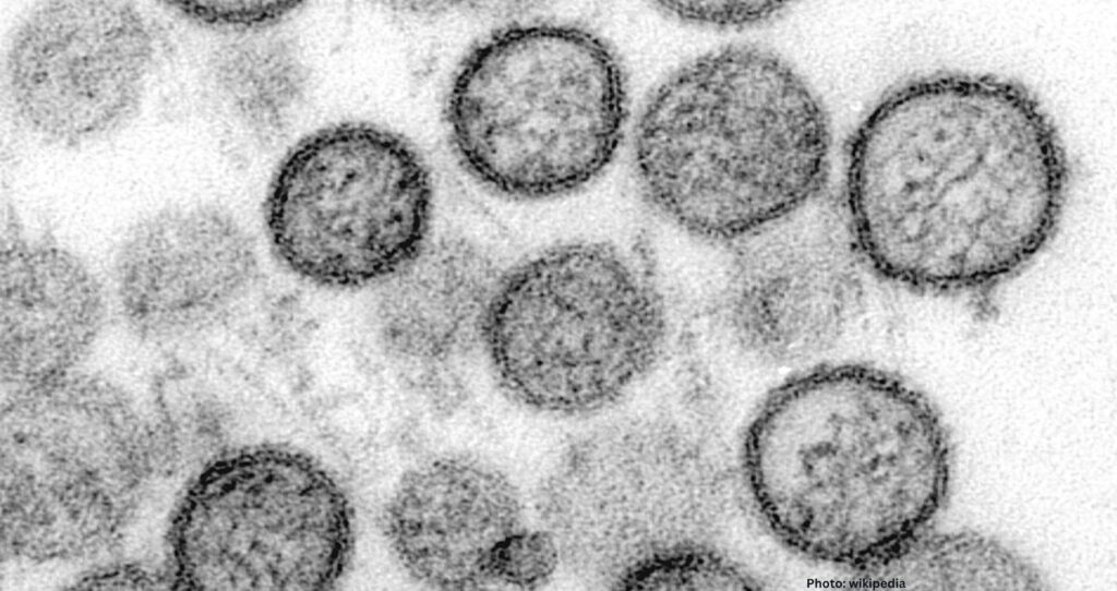 Cruise Ship Outbreak Claims Three Lives Amid Hantavirus Concerns