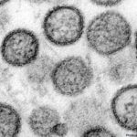 Featured & Cover Cruise Ship Outbreak Claims Three Lives Amid Hantavirus Concerns