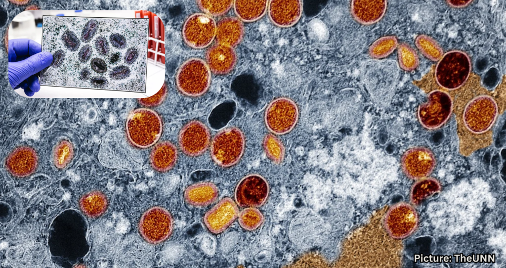 First Clade I Mpox Case Confirmed in Connecticut After European Travel