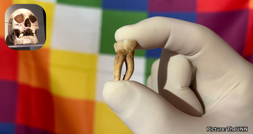 New Study Finds Leprosy in the Americas Before European Arrival
