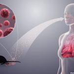 Featured & Cover What to Know About Hantavirus Linked to Cruise Ship Outbreak
