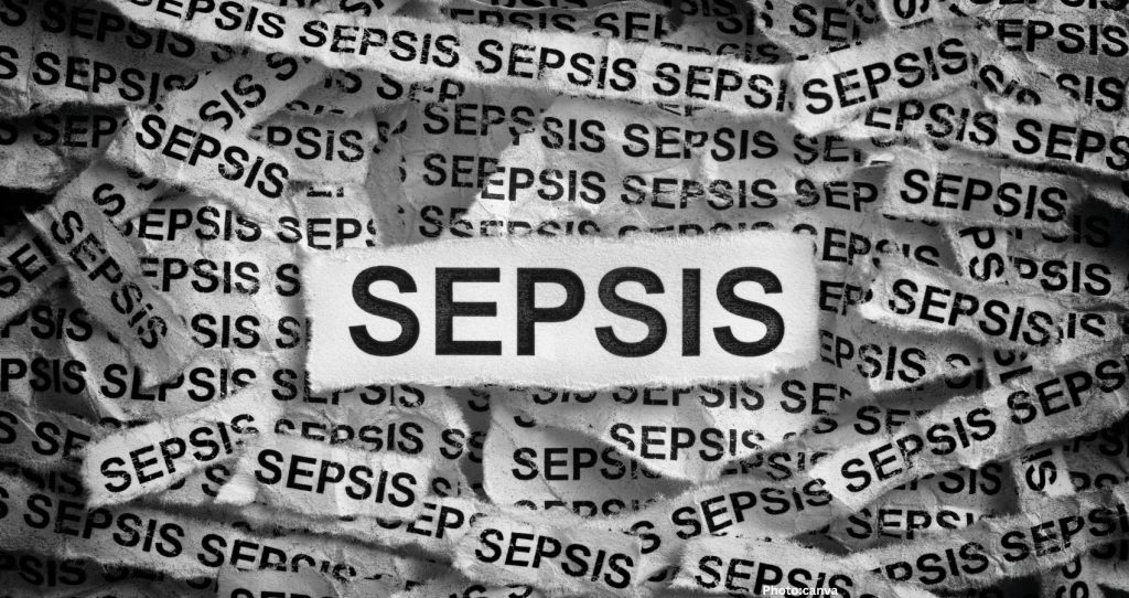 How Pneumonia Can Progress to Sepsis: Insights from Doctors