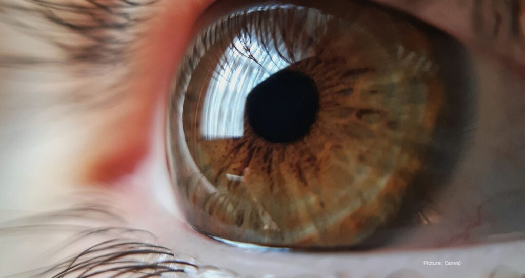 Understanding Early Stage Glaucoma: Key Insights for Patients