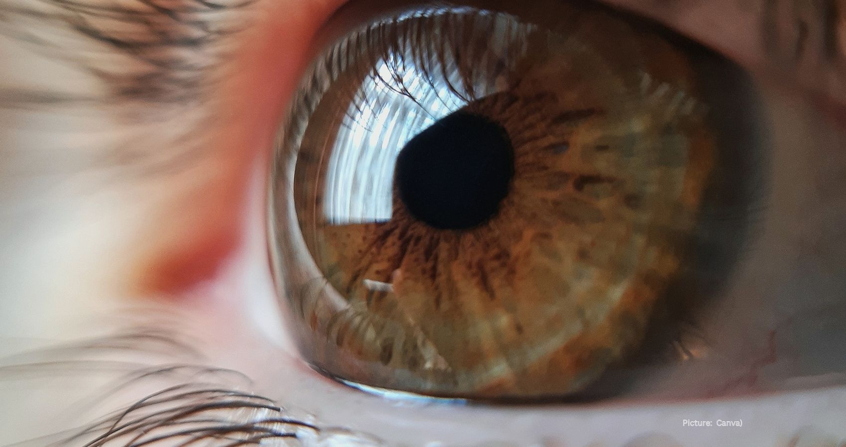 The UNN Cover Understanding Early Stage Glaucoma Key Insights for Patients