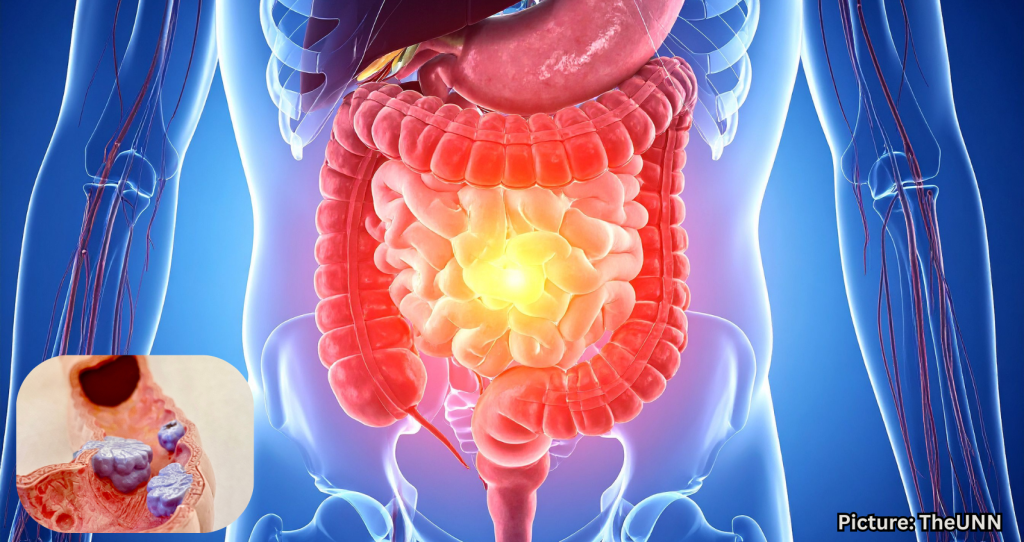 Coping Strategies for Indian-Americans Facing Colorectal Cancer
