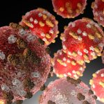 Featured & Cover Measles Infected Traveler Exposes Passengers at LAX and Nearby Hotel