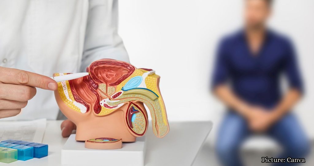 Considerations for Hydronephrosis in Prostate Disease Screening
