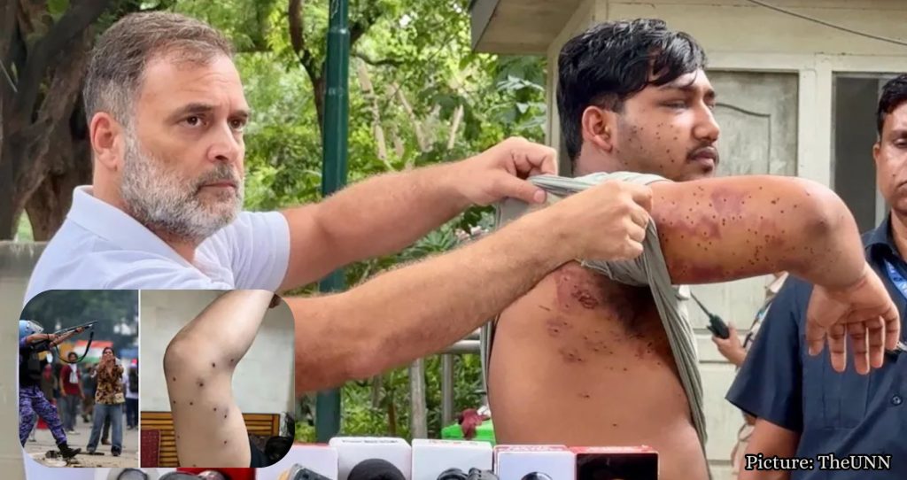 Featured & Cover Investigation Confirms Use of Pellet Guns in Delhi Protest