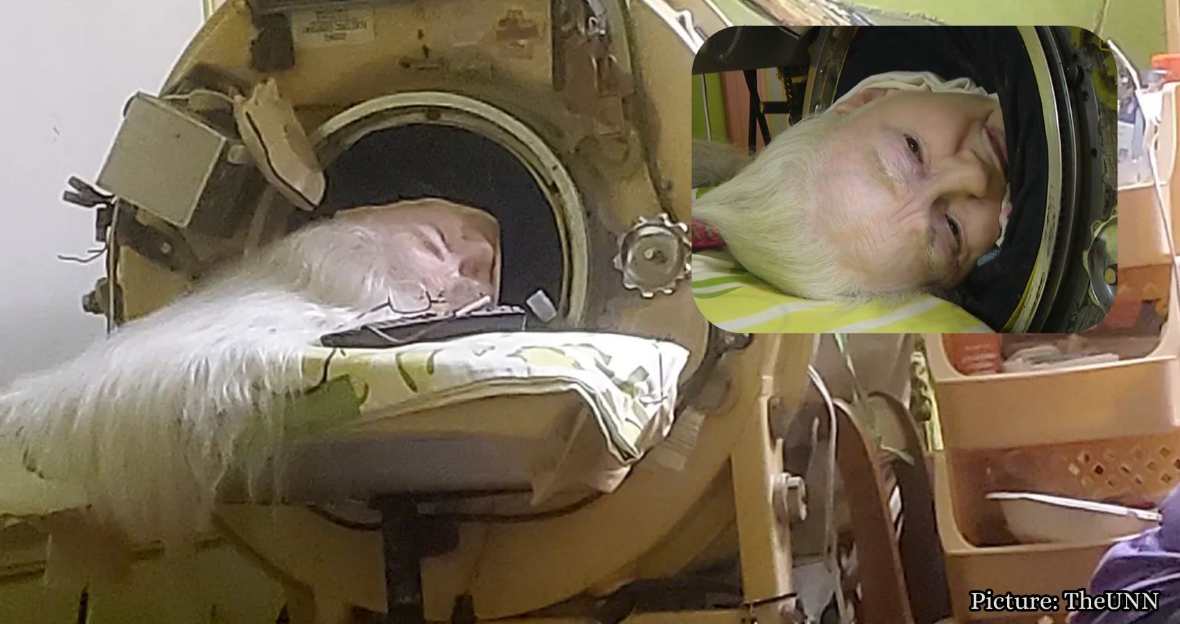 Featured & Cover Last American Iron Lung User Dies at 78 After Polio Diagnosis