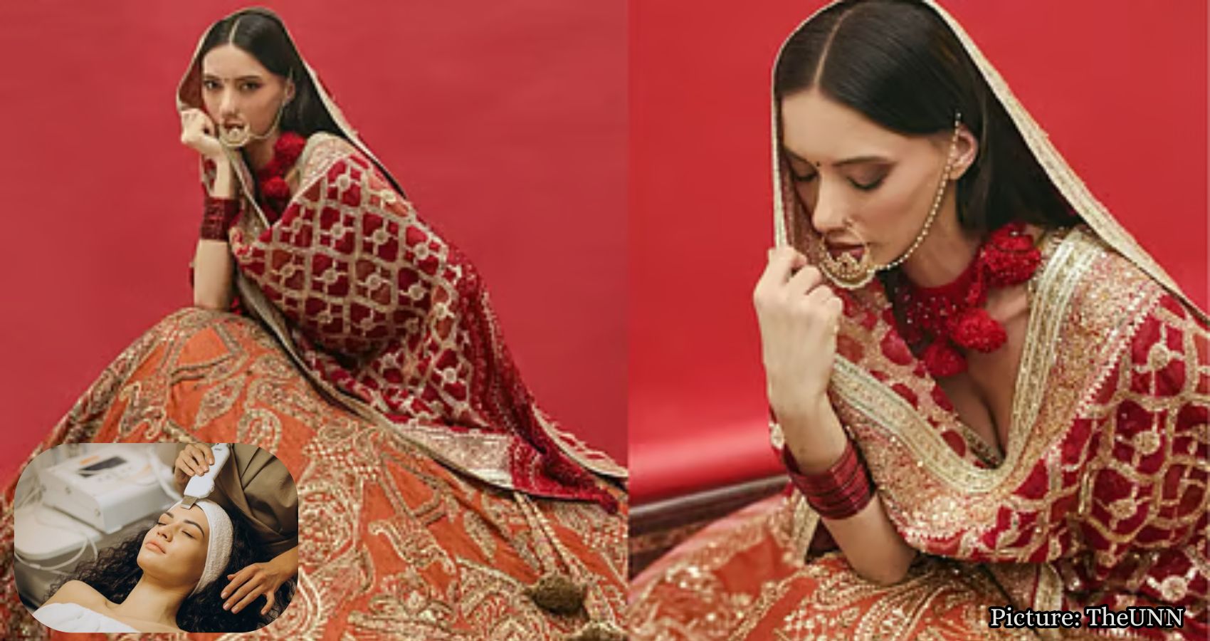 Featured & Cover Bride Warns About Risks of Beauty Treatments Before Wedding Da