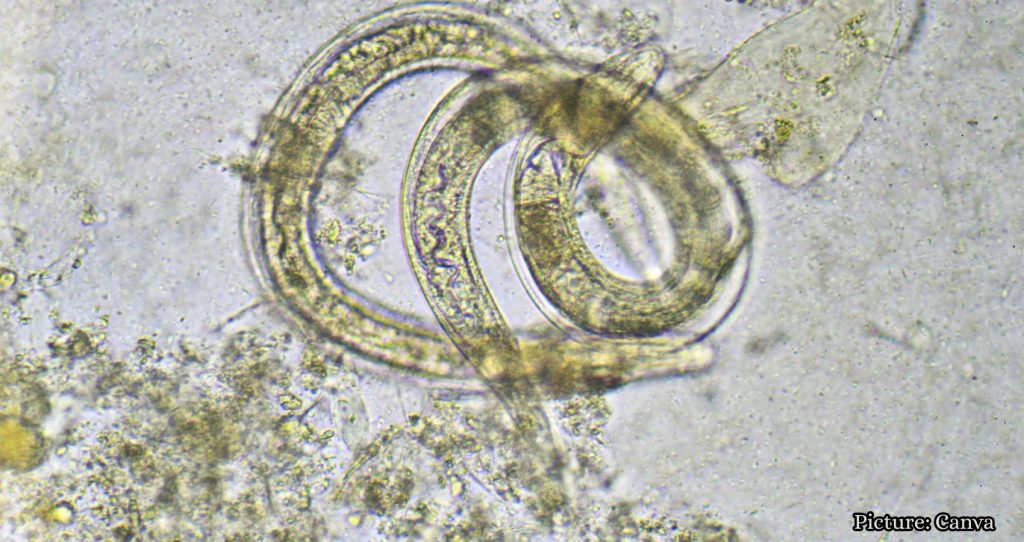Cyclospora Outbreak Raises Concerns Over Future Foodborne Illnesses