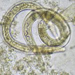 Featured & Cover Cyclospora Outbreak Raises Concerns Over Future Foodborne Illnesses