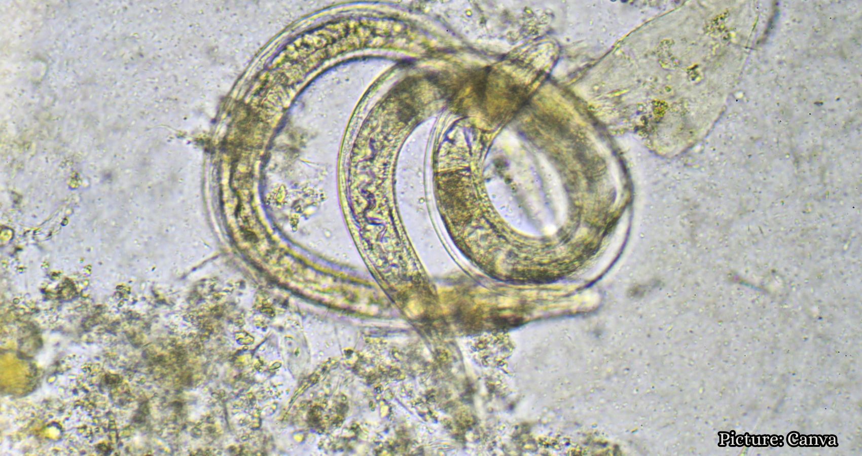 Featured & Cover Cyclospora Outbreak Raises Concerns Over Future Foodborne Illnesses